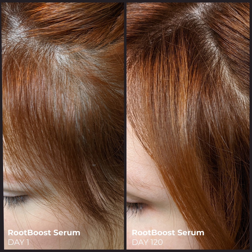 EVOLVh  Better Roots System